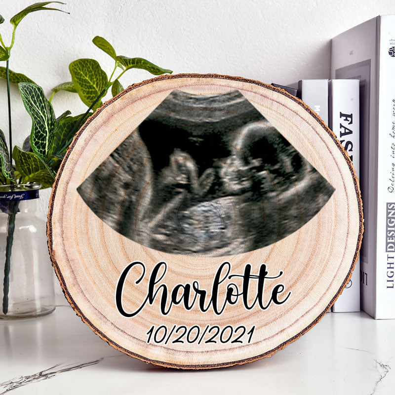 Baby Sonogram Photo, Personalized Baby Photo Wood Slice, Custom Photo Gift, Gift For Mom